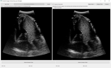 Tartaglia adquisiciones